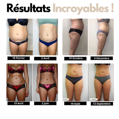 T-shirt Compression - Anti-cellulite