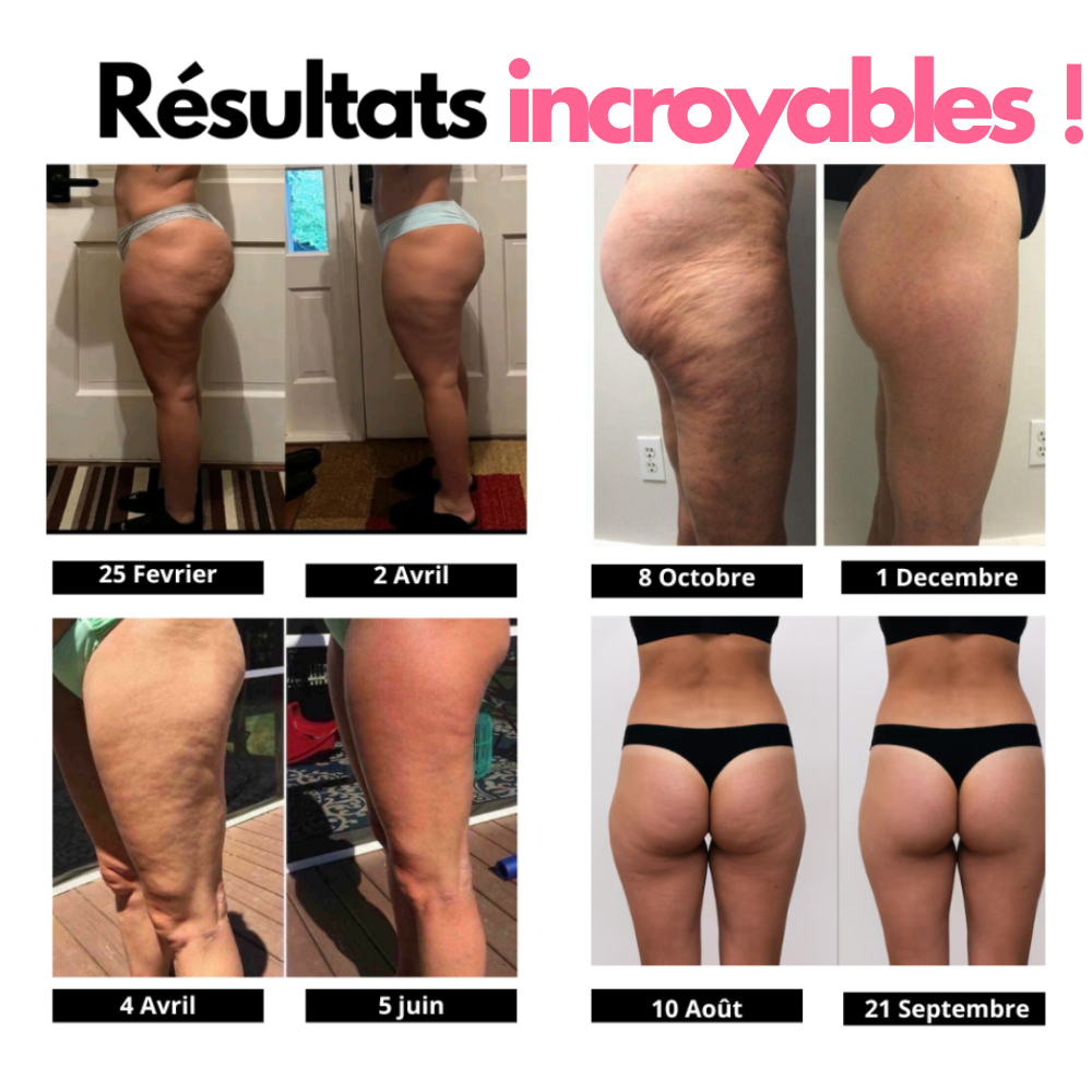 Legging BodySculpt - Anti-cellulite